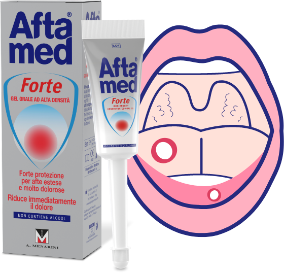 aftagelforte